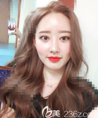 韓國首爾麗絲塔整形隆鼻案例 韓國首爾麗絲塔整形隆鼻案例