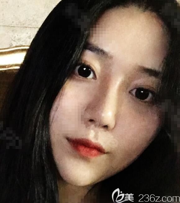 韓國維摩姜在九做的吸脂加脂肪填充他們都說不相信是假的