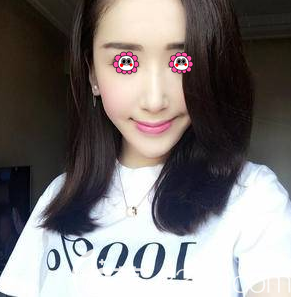 北京畫美做鼻修復(fù)第67天樣子