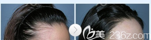 東莞美立方植發(fā)怎么樣