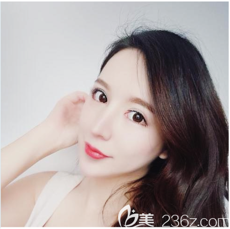 公開(kāi)我去廣州藝美找張濤做雙眼皮失敗修復(fù)找李闖做鼻綜合隆鼻修復(fù)的親身經(jīng)歷