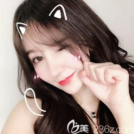 廣州藝美李闖鼻綜合隆鼻+張濤雙眼皮失敗修復(fù)案例 廣州藝美李闖鼻綜合隆鼻+張濤雙眼皮失敗修復(fù)案例