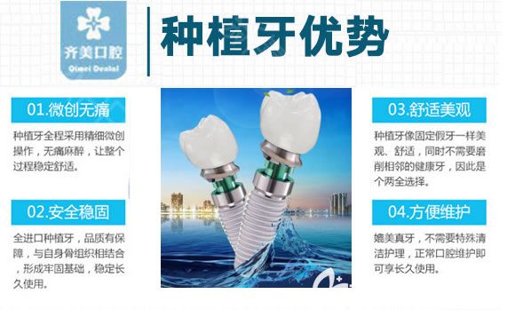 重慶齊美口腔高精3D導板種植牙技術優(yōu)勢 重慶齊美口腔高精3D導板種植牙技術優(yōu)勢