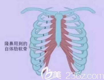 肋軟骨隆鼻取肋軟骨的位置