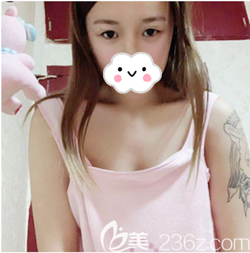 去湛<!--<i data=20240703-sp></i>-->美做隆胸手術(shù)前的樣子 去湛<!--<i data=20240703-sp></i>-->美做隆胸手術(shù)前的樣子