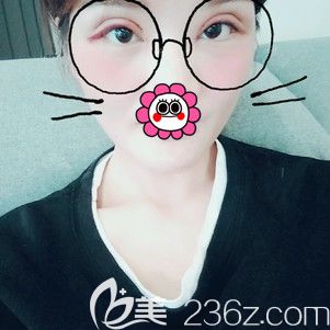 2天冰敷+1天熱敷后雙眼皮恢復(fù)效果 2天冰敷+1天熱敷后雙眼皮恢復(fù)效果