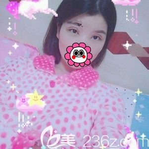 術(shù)后一周拆線眼部整形恢復(fù) 術(shù)后一周拆線眼部整形恢復(fù)