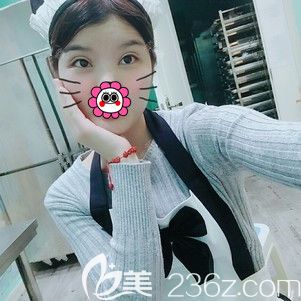 雙眼皮+開(kāi)眼角術(shù)后半個(gè)月恢復(fù) 雙眼皮+開(kāi)眼角術(shù)后半個(gè)月恢復(fù)