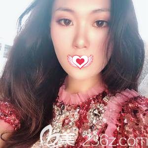 王亞勇為我這樣雙眼皮術(shù)后18天已經(jīng)消腫