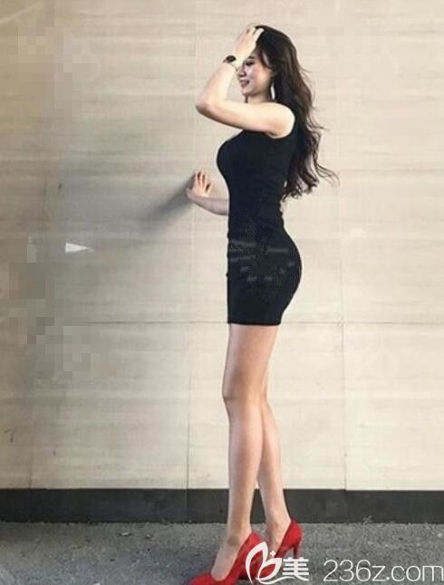 【韓國(guó)女神整形醫(yī)院：假體豐臀怎么樣