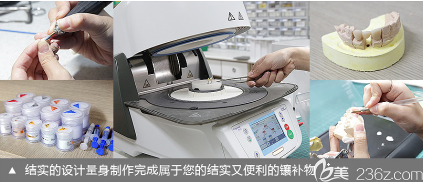 韓國(guó)來(lái)一菲LIVE牙科醫(yī)院鑲補(bǔ)物制作過(guò)程 韓國(guó)來(lái)一菲LIVE牙科醫(yī)院鑲補(bǔ)物制作過(guò)程