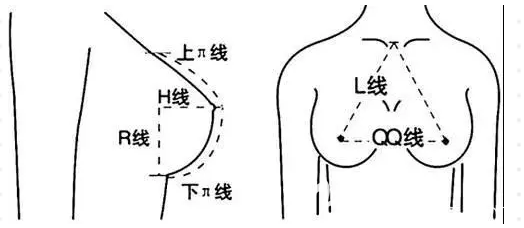 隆胸手術美學標準 隆胸手術美學標準