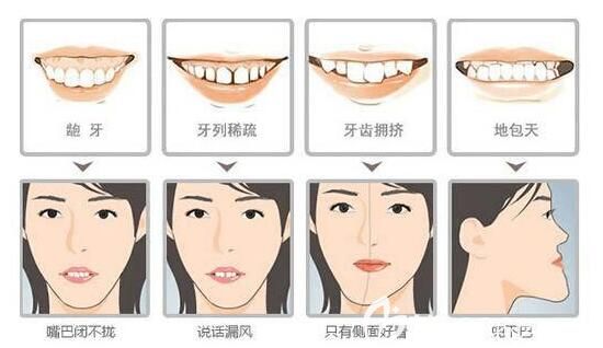 南京博韻口腔許辰林醫(yī)生牙齒矯正圖 南京博韻口腔許辰林醫(yī)生牙齒矯正圖