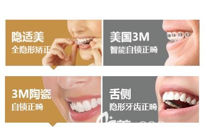 隱適美隱形牙套和3m陶瓷牙套的優(yōu)勢(shì) 隱適美隱形牙套和3m陶瓷牙套的優(yōu)勢(shì)