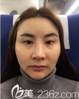 術(shù)前的我 術(shù)前的我