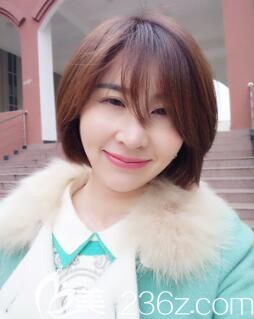 胡煜面部線雕術(shù)后1個(gè)月 胡煜面部線雕術(shù)后1個(gè)月