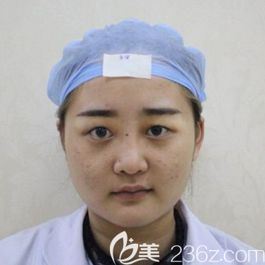 在佛山夢(mèng)露做雙眼皮隆鼻前的照片 在佛山夢(mèng)露做雙眼皮隆鼻前的照片