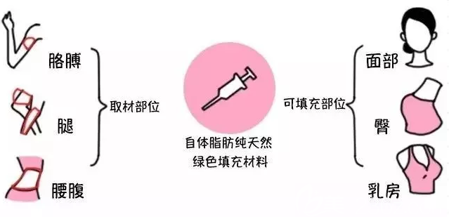 自體脂肪移植過程 自體脂肪移植過程