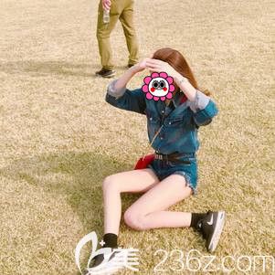 術后快兩個月吸脂瘦大腿后情況