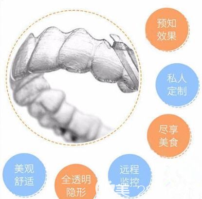 張醫(yī)生講解的正雅隱形矯正器可改善的牙齒狀態(tài)