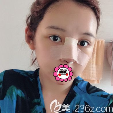 術(shù)后臉部拆掉繃帶恢復(fù)效果 術(shù)后臉部拆掉繃帶恢復(fù)效果