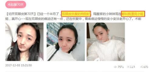 <!--<i data=20240703-sp></i>-->醫(yī)療美容醫(yī)院：馬力雙眼皮反饋