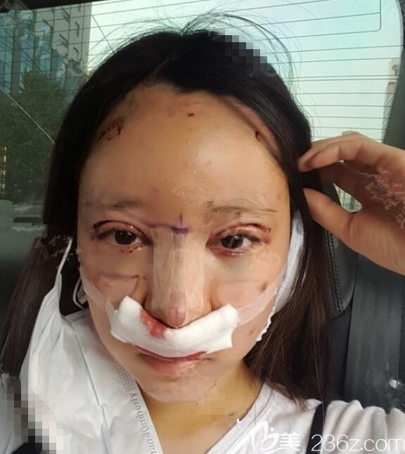 術(shù)后<span style=