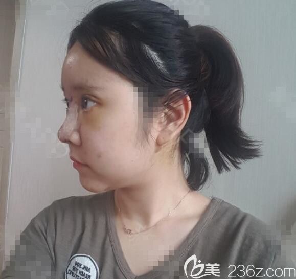 剛做完手術(shù)