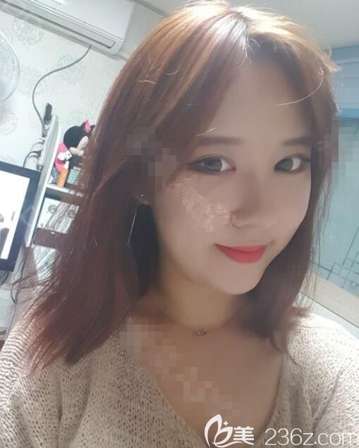 韓國德麗珍整形醫(yī)院眼鼻真人<span style=