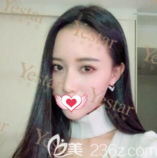 在長(zhǎng)沙做發(fā)際線種植37天<span style= 在長(zhǎng)沙做發(fā)際線種植37天<span style=