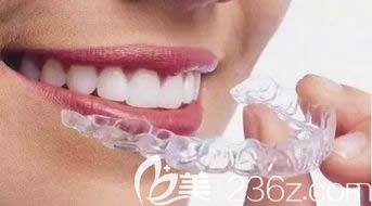 全隱形牙套正畸示意圖 全隱形牙套正畸示意圖