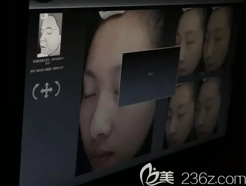 我在北京藝星祛斑前做皮膚檢測 我在北京藝星祛斑前做皮膚檢測