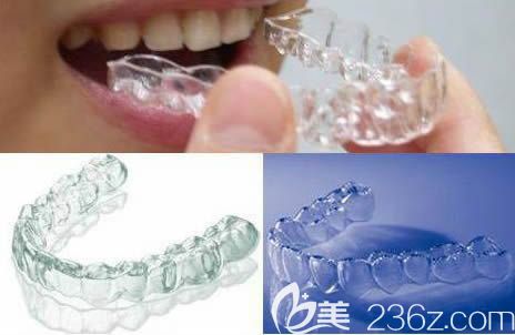 牙套的種類和價格請看湛江致美口腔正畸醫(yī)生<!--<i data=20240703-sp></i>-->宏解答 牙套的種類和價格請看湛江致美口腔正畸醫(yī)生<!--<i data=20240703-sp></i>-->宏解答