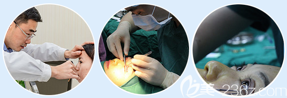 江門夢想周俊醫(yī)生雙眼皮手術(shù)過程 江門夢想周俊醫(yī)生雙眼皮手術(shù)過程