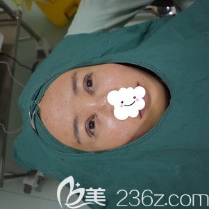 剛做完眼綜合術(shù)后效果分享