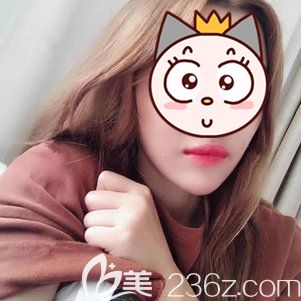 做玻尿酸墊下巴術(shù)后13天針眼消失