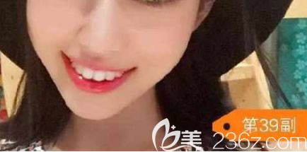 第21副和39副的變化圖