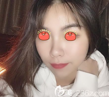 在紹興維美整形醫(yī)院做完皮秒激光祛斑后，我發(fā)現(xiàn)我解鎖了新形象,而且手術(shù)收費不高