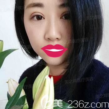 做雙眼皮術(shù)后3天恢復(fù)效果程度