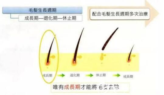 一定要進行多次治療