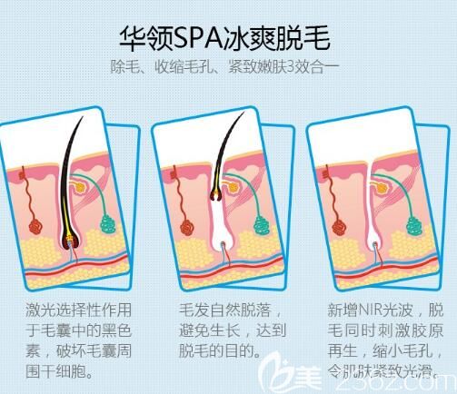 去鄭州華領找屈琳麗醫(yī)生體驗了一次無痛“冰點脫毛”