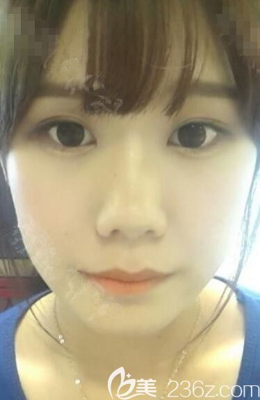 必嫵整形醫(yī)院輪廓怎么樣