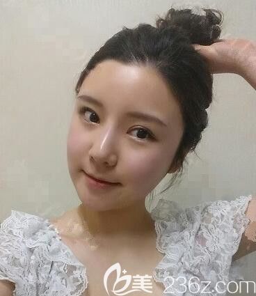 JJ洪鎮(zhèn)柱整形梁海元輪廓怎么樣 JJ洪鎮(zhèn)柱整形梁海元輪廓怎么樣