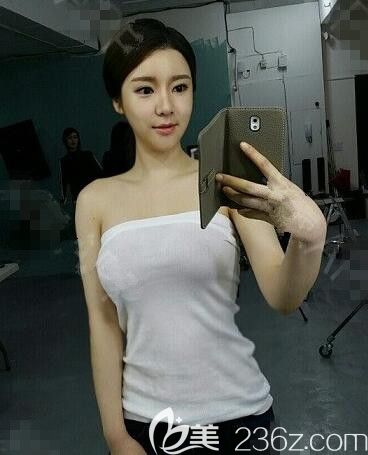 JJ洪鎮(zhèn)柱整形怎么樣 JJ洪鎮(zhèn)柱整形怎么樣