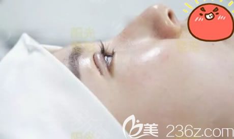 剛做完雙眼皮和開眼角的圖片 剛做完雙眼皮和開眼角的圖片