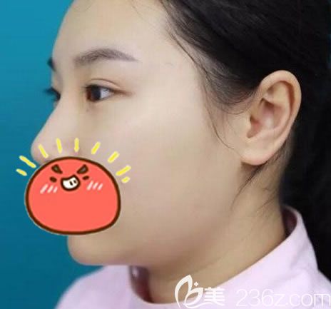 義烏陽光整容醫(yī)院做雙眼皮<span style= 義烏陽光整容醫(yī)院做雙眼皮<span style=