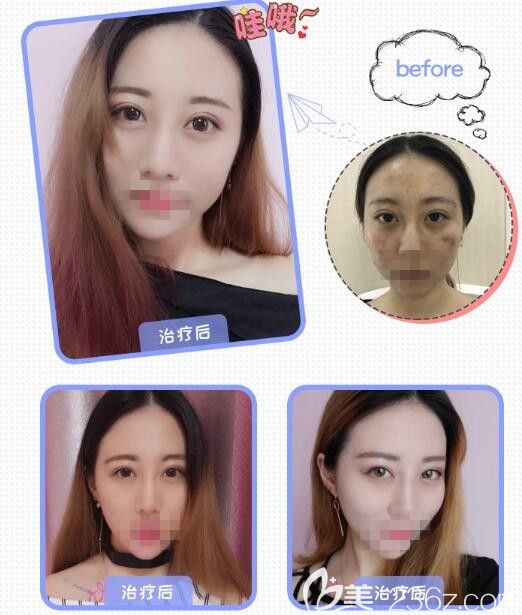  華領真人案例為你展示真實效果