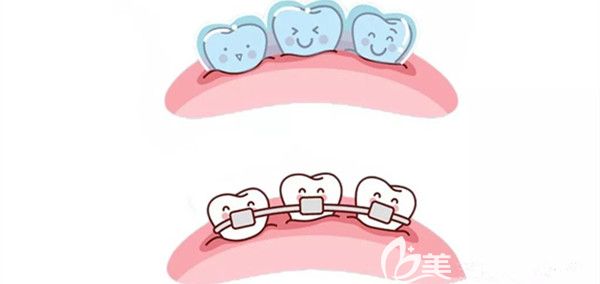 口腔正畸后的<span style= 口腔正畸后的<span style=