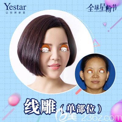 武漢藝星線雕單部位除皺術(shù)前術(shù)后對比