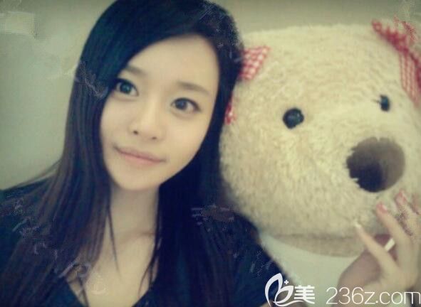 下巴太長(zhǎng)太寬在韓國(guó)綺林整形外科做了下巴T型截骨縮小寬下巴我的氣質(zhì)提升了一個(gè)檔次